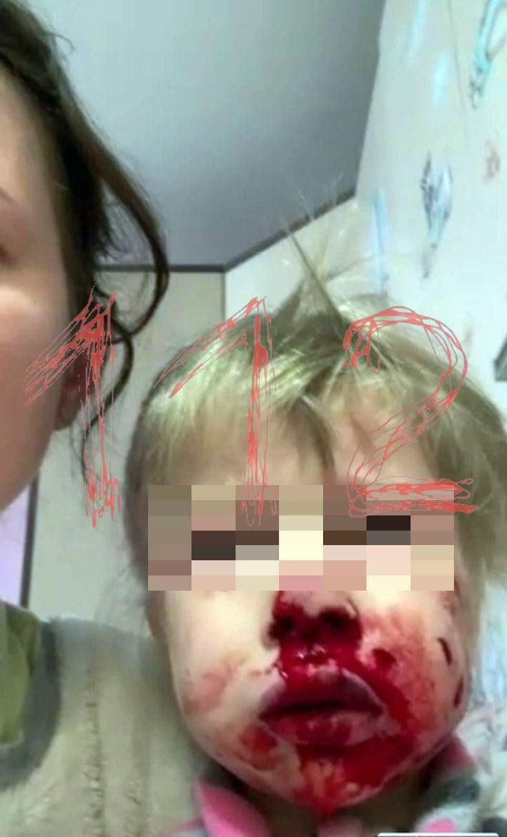 Пострадавшая