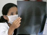 В Бухаресте столкнулись три трамвая: 50 раненых. 258411.jpeg