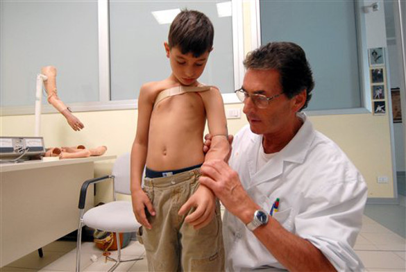 Разработан протез, умеющий читать мысли. протез, сила мысли, протезирование