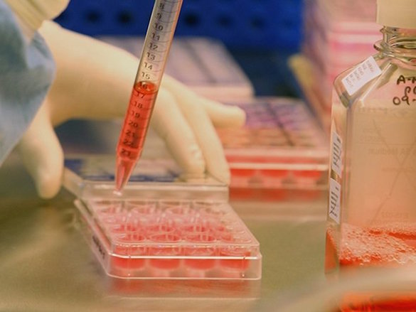 Названа самая опасная в России болезнь. 375532.jpeg