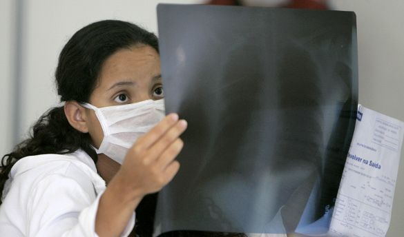 Хрустеть пальцами не вредно. 311686.jpeg