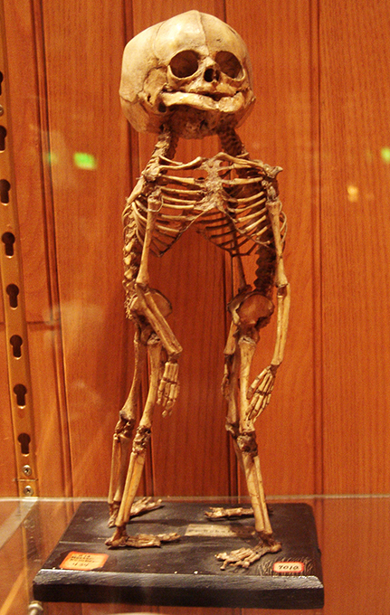 Музей не для слабонервных