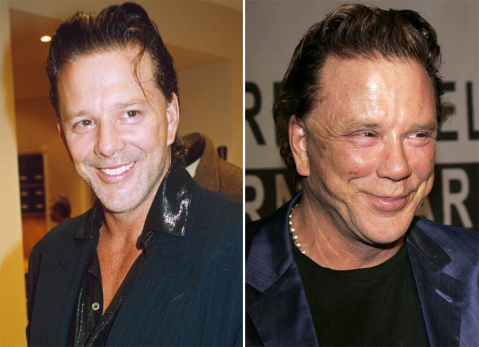 Искалеченные искусством любимцы публики: Микки Рурк