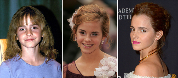 Что стало с актерами фильмов о Гарри Поттере: Эмма Уотсон