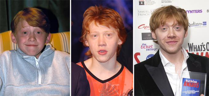 Что стало с актерами фильмов о Гарри Поттере: Руперт Гринт