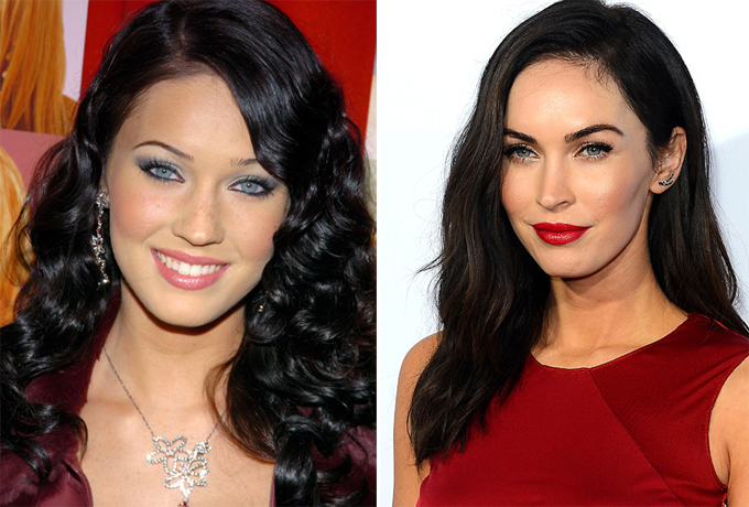 Бес пластической хирургии испортил улыбки звезд