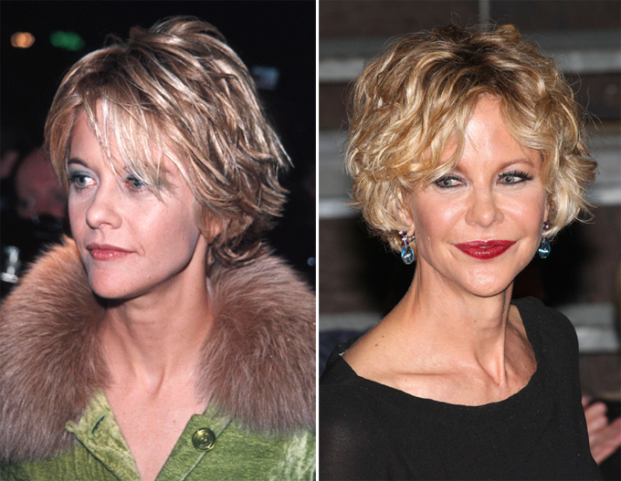 Бес пластической хирургии испортил улыбки звезд