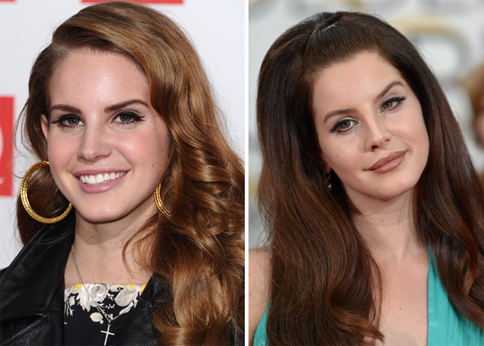 Бес пластической хирургии испортил улыбки звезд