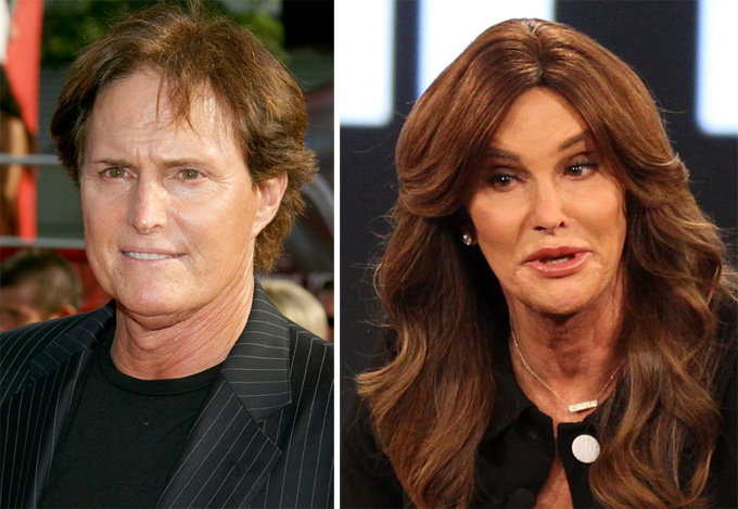 Шокирующие преображения знаменитостей