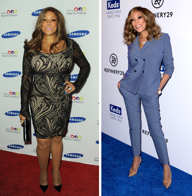 Шокирующие преображения знаменитостей