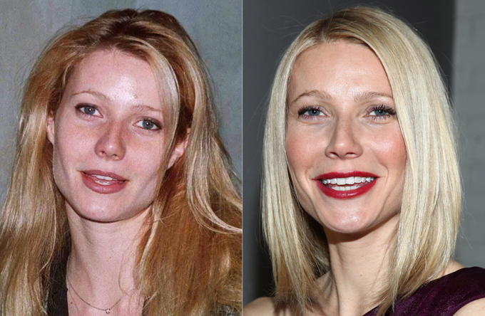 Особое внимание звездному носу