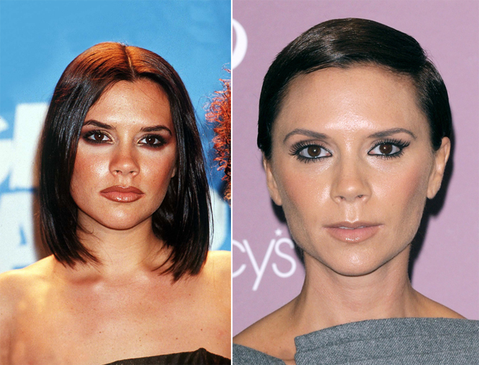 Особое внимание звездному носу