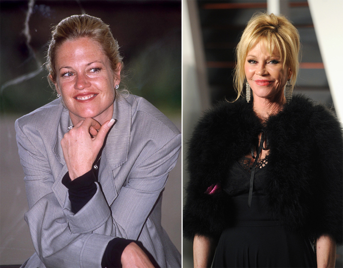 Особое внимание звездному носу