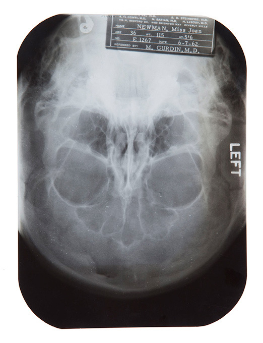 "Пластические тайны" Мэрилин Монро выставят на торги