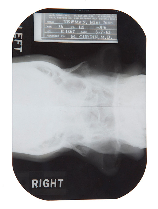 "Пластические тайны" Мэрилин Монро выставят на торги