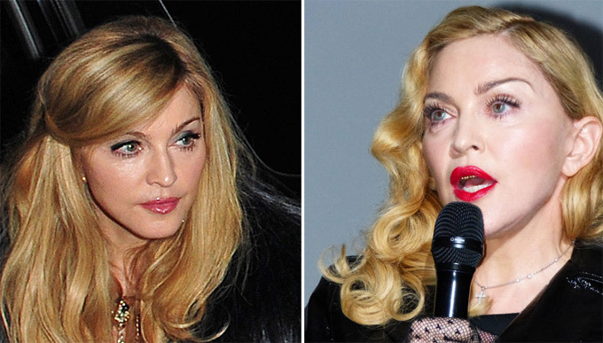 Мадонна. Звездные неудачи, или Ошибки пластических хирургов