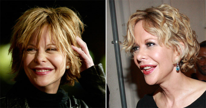 Мэг Райан. Звездные неудачи, или Ошибки пластических хирургов