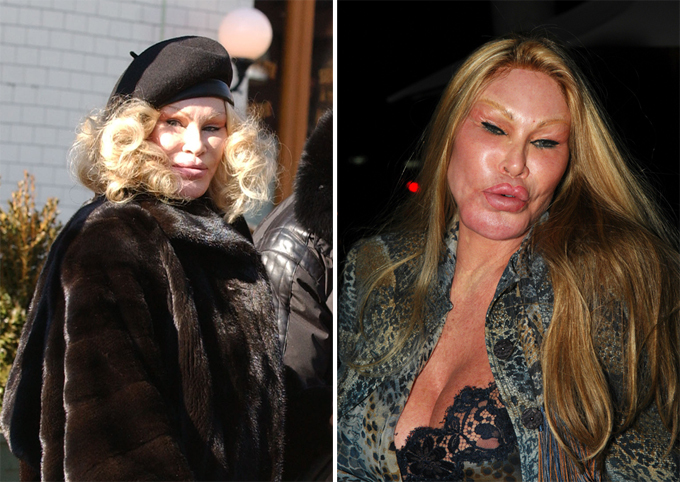 Джоселин Вильденштейн. Звездные неудачи, или Ошибки пластических хирургов