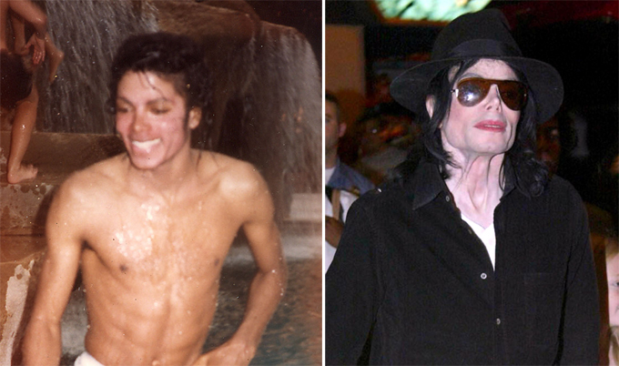 Майкл Джексон. Звездные неудачи, или Ошибки пластических хирургов