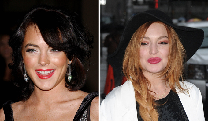 Линдси Лохан. Звездные неудачи, или Ошибки пластических хирургов