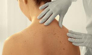 Местные агенты, криохирругия и другие виды терапии, применяемые в дерматологии