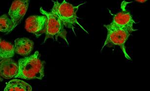 Онколог Федянин заявил, что опухоли на коже позволяют самостоятельно диагностировать рак