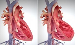 Россиянам рассказали, что такое ОКС и какая помощь необходима