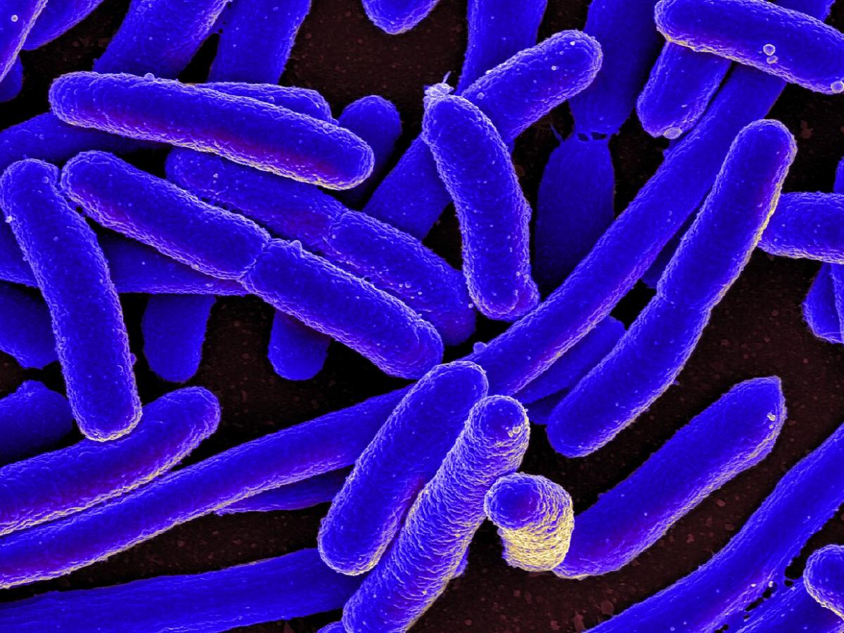 Новый эукариот найден в горячем ручье Лассен-Парка  микробиолог Анджела Оливерио