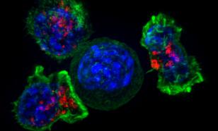 Врач Гадзиян нашёл связь между кровью в моче и развитием рака