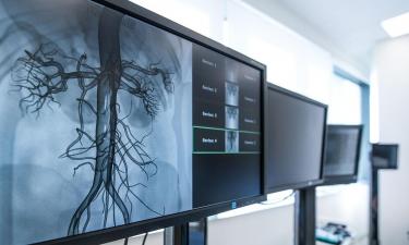 Общий холестерин не отражает реальной картины здоровья сосудов — врач Калинчев