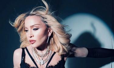 Мадонна и её неожиданный поворот: как молодой бойфренд вдохновил её на отказ от филлеров