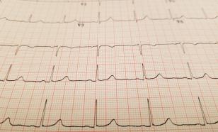 Искусственный интеллект способен предсказать риск смерти по ЭКГ