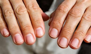 Изменения ногтей сигнализируют о нарушениях здоровья — подолог Дарья Волкова