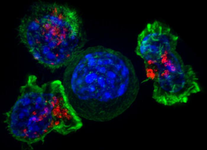 Ученые нашли способ подавить рост рака молочной железы