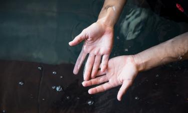 Гипергидроз: когда потные ладони – это не просто жара — 5 тревожных звоночков