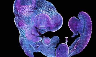 Нейросети в зародыше: на что решились исследователи, чтобы понять начало разума