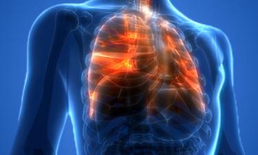 Пациенты с постковидным фиброзом в три раза чаще болеют пневмонией — врач Цагараева