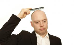 Облысение у мужчин: причины, признаки, лечение