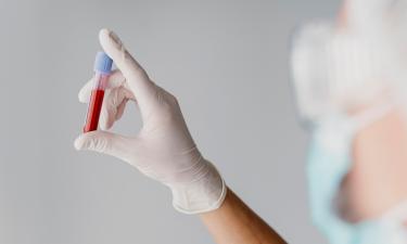 Кровь в моче главный ранний признак рака почек и мочевого пузыря — нефролог Шилов