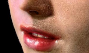 Что делать, если зимой сильно сохнут и трескаются губы