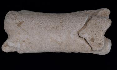 Кости рассказали всё: редкая болезнь византийского ребёнка раскрыла тайны средневековой медицины