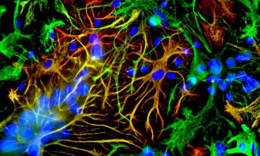 Новая лабораторная модель БАС воспроизводит ключевые аспекты болезни