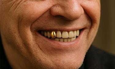 Русский рынок зубных артефактов: неожиданный бизнес, о котором никто не говорил — закон не против