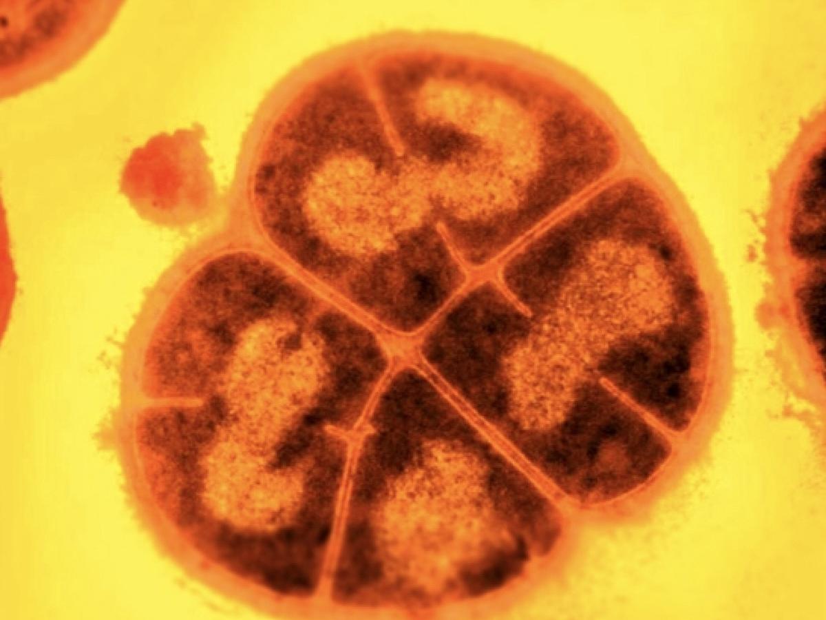 Российские студенты придумали, как ловить инфекцию до вспышки