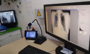 Жители Черкасс возмущены "русскоговорящим" флюрографом