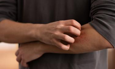 ВОЗ: комар остаётся самым опасным животным на планете — более 1 млн жертв в год