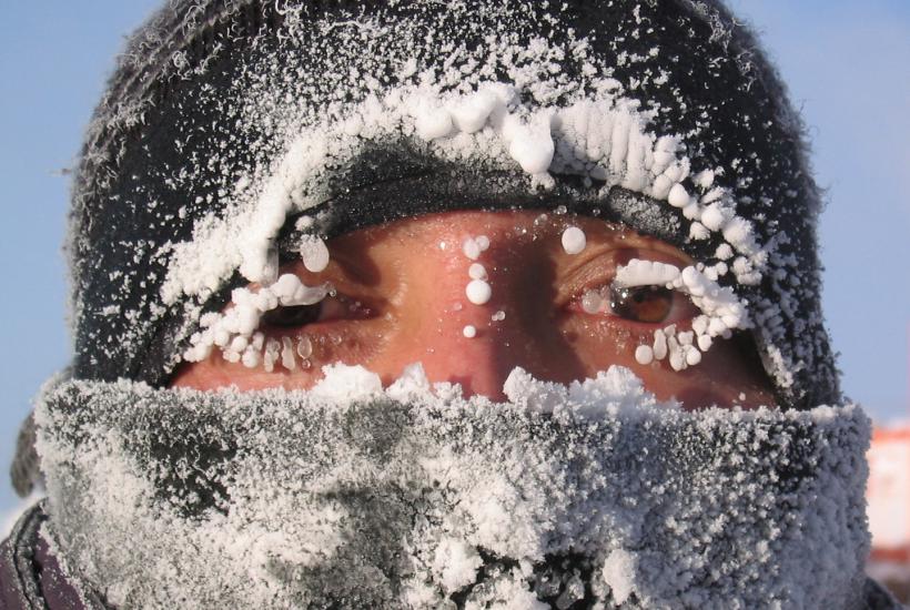 Замерзшее лицо