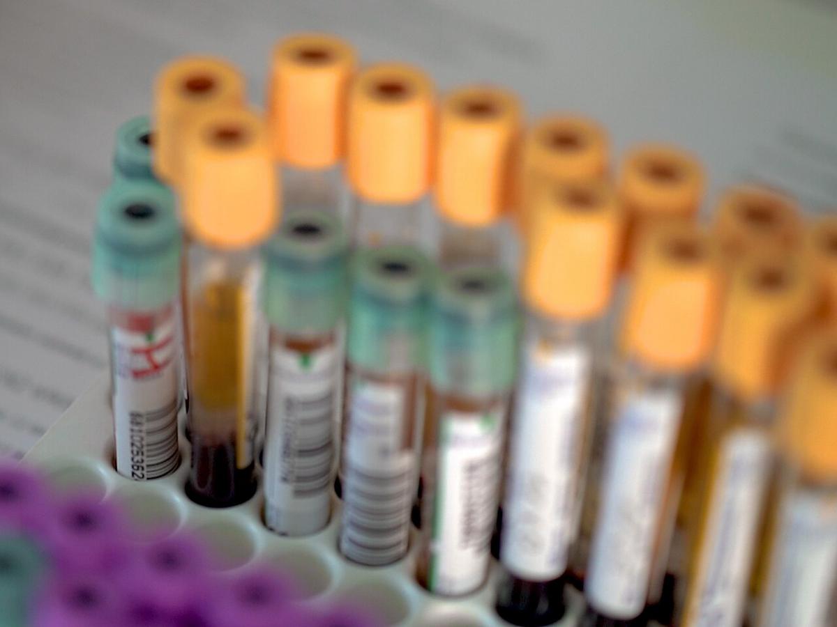 Обычный тест раскрыл тревожную правду о риске смерти