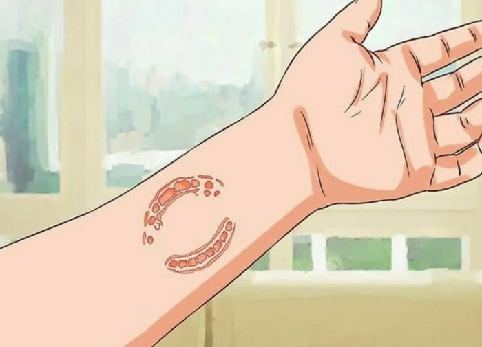 Учёные подвергли сомнению правильность поиска преступника по следам от зубов