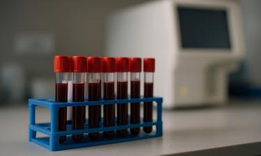 Метаболический профиль крови предсказывает болезни за годы — учёные